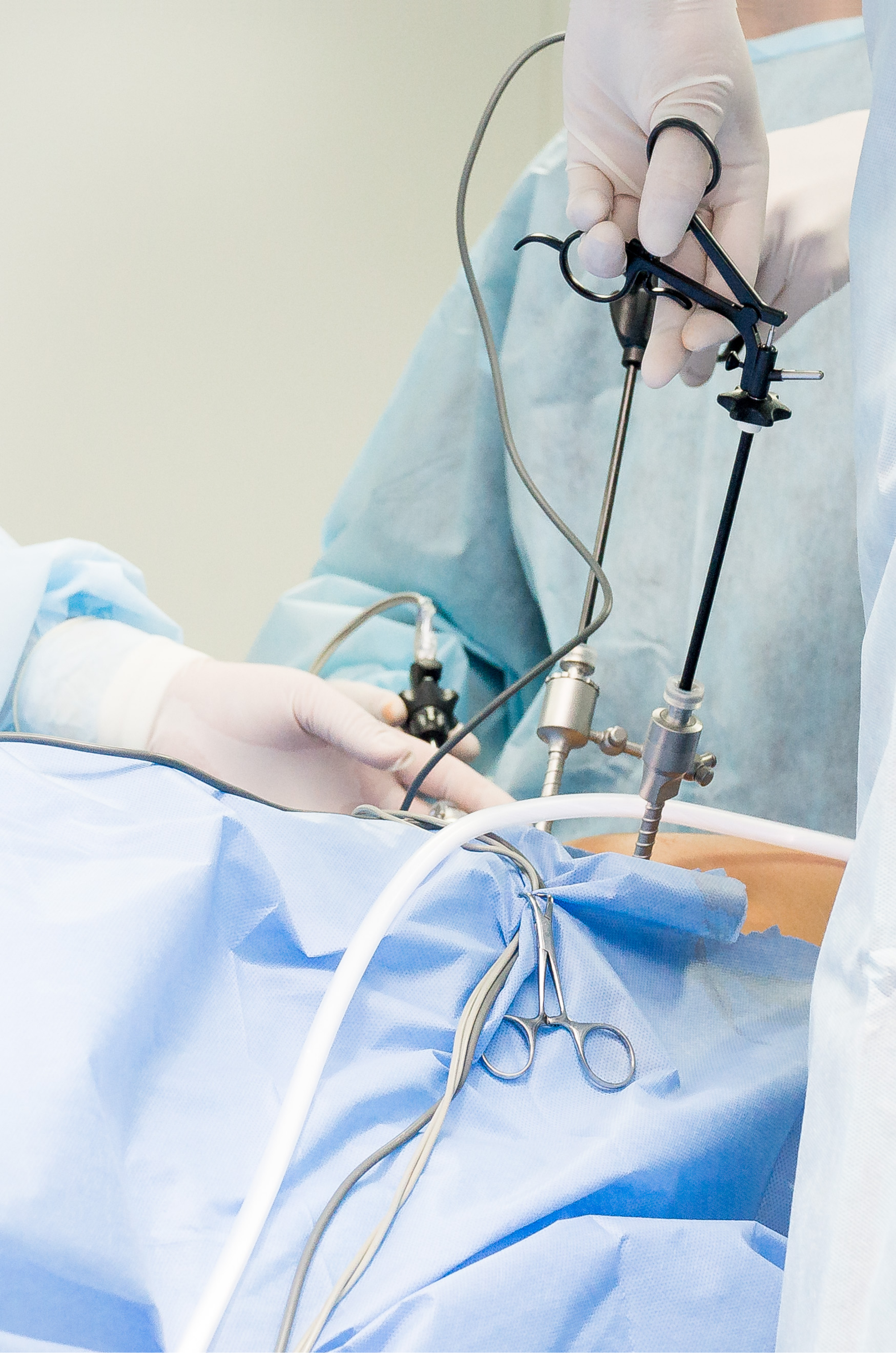 Advanced Laparoscopic Procedures